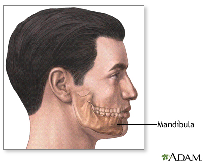 Agrandamiento del mentón (genioplastia) - serie