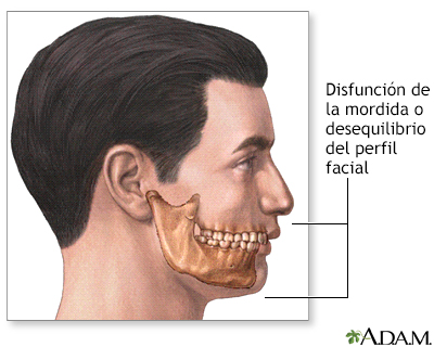 Indicaciones