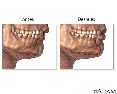 Cuidados postoperatorios