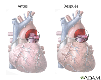 Cuidados postoperatorios