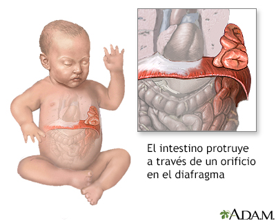 Indicaciones