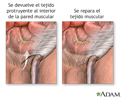 Procedimiento