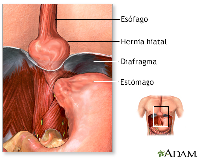 Indicaciones