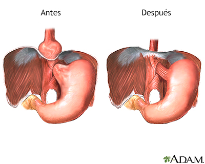 Cuidados postoperatorios