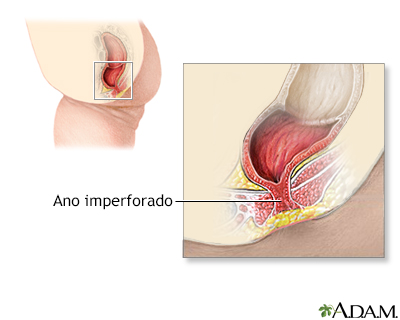 Indicaciones