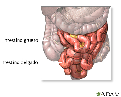 Resección de intestino delgado - serie