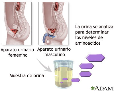 Prueba de aminoaciduria en orina