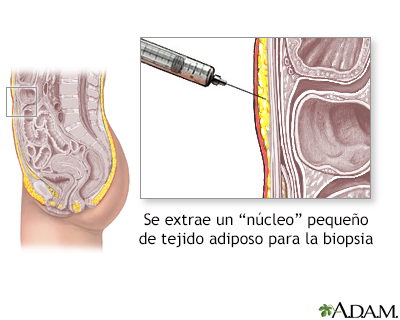 Biopsia de tejido graso