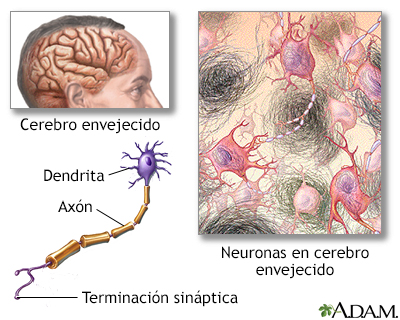 Tejido nervioso envejecido