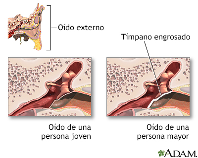 Cambios auditivos por el envejecimiento