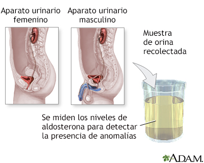 Examen del nivel de aldosterona