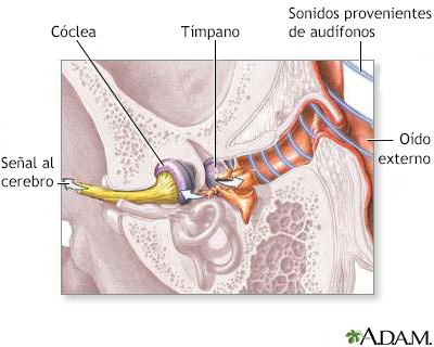 Transmisión de las ondas sonoras