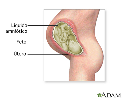 Líquido amniótico