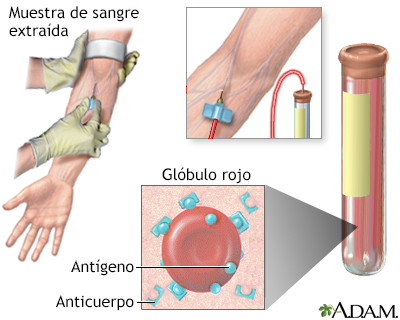 Titulación de anticuerpo