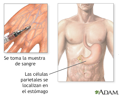 Anticuerpos de las células parietales