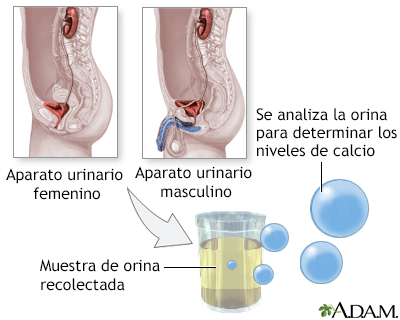 Examen de calcio en orina