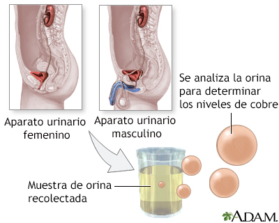 Examen de cobre en orina