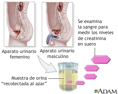 Prueba de creatinina en orina