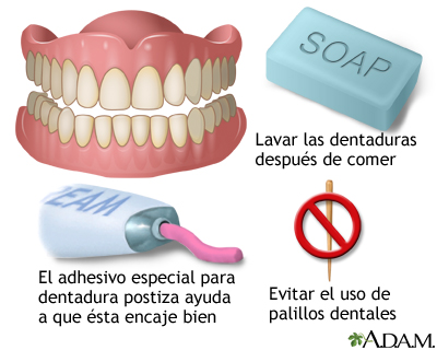 Cuidado de la dentadura postiza