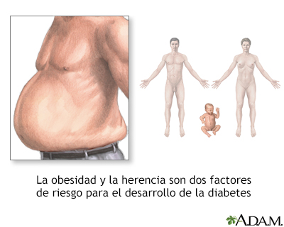 Factores de riesgo de diabetes