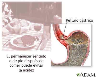 Prevención de la acedía