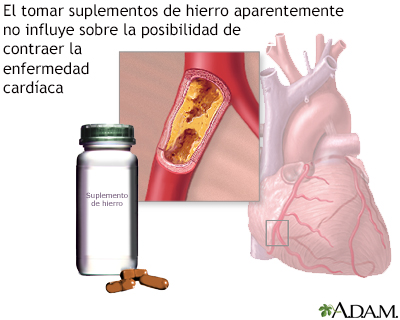 Suplementos de hierro