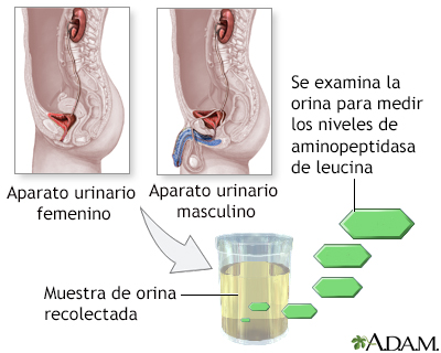 Prueba de aminopeptidasa de leucina en orina