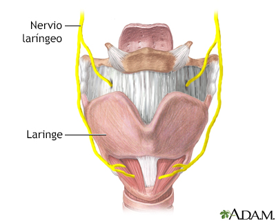 Daño al nervio laríngeo