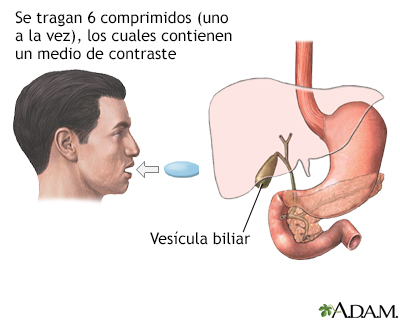 Colecistograma