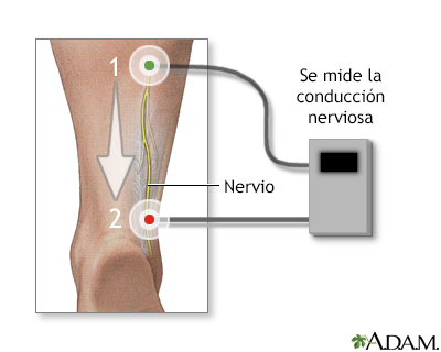 Prueba de conducción nerviosa