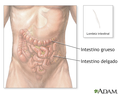 Lombrices intestinales