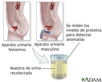 Prueba de proteína en la orina