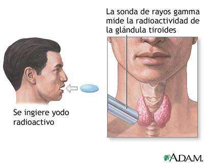 Prueba de captación de tiroides