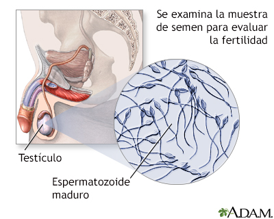 Análisis del semen