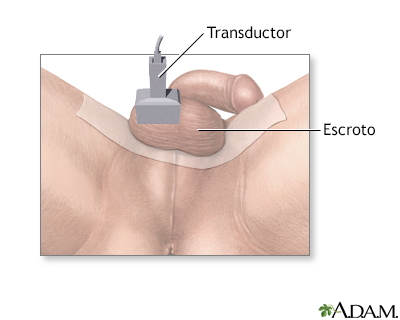 Ultrasonido testicular