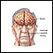 Accidente cerebrovascular - Serie